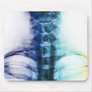 Mousepad Arte cervical do raio X de Digitas