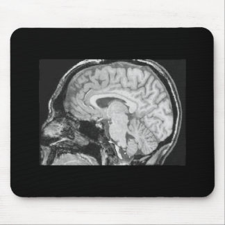 Mousepad Cérebro MRI