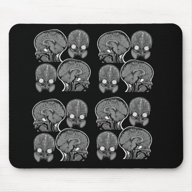 MOUSEPAD CÉREBROS! (MRI) (Frente)