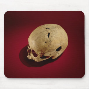 Mousepad Crânio de Trepanned
