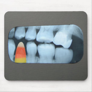 Mousepad Doces de milho no Xray