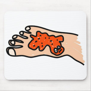Mousepad Doença de pé
