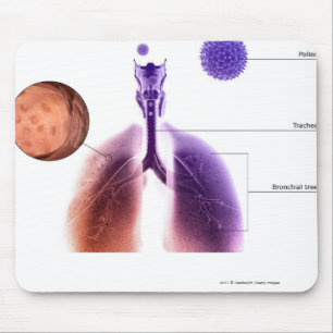 Mousepad Ilustração de um ataque de asma do pólen