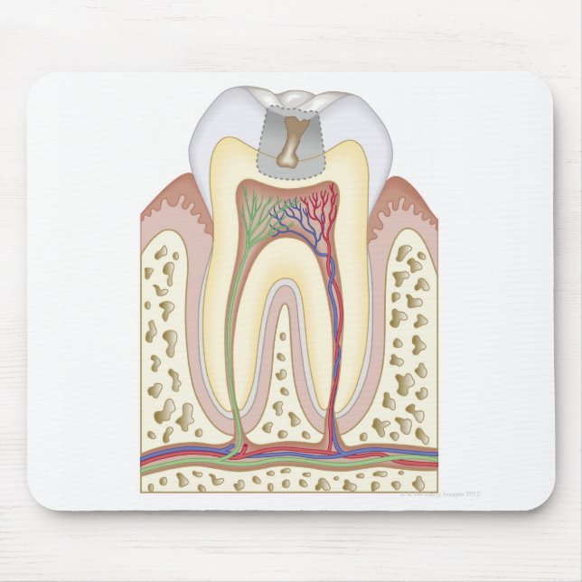 Mousepad Ilustração do Decaimento dos Dentes (Frente)