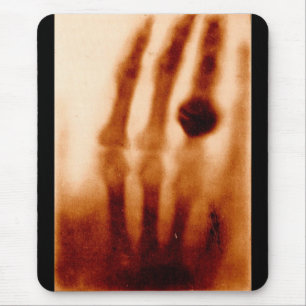 Mousepad O primeiro Raio X, 1901, fotografia