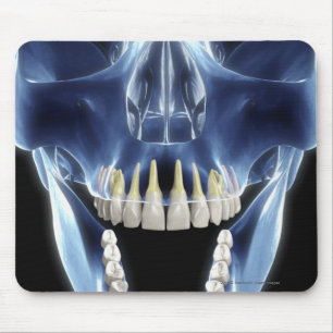 Mousepad Olhar do estilo do raio X nos dentes humanos