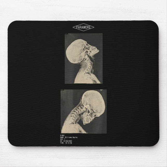 Mousepad Paramore cropped headbanger médicos de raio-x  (Frente)
