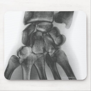 Mousepad Pulso normal, raio X