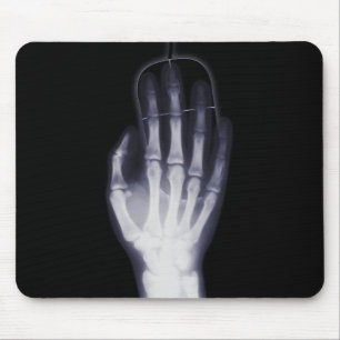 Mousepad Raio X engraçado da mão para o addictioner do
