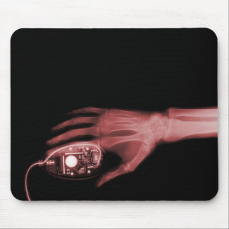 Mousepad Rato de Mão e Computador de Raio X