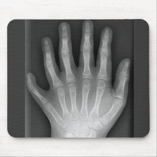 Mousepad Seis mãos apontado, raridade médica, raio X
