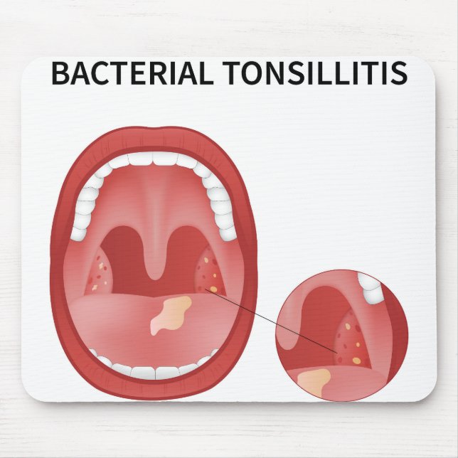 Mousepad Tossilite bacteriana (Frente)