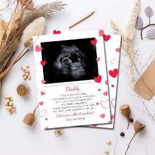 Namorados para Pai de Bump