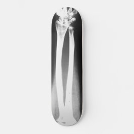 O skate Breaks de Bradley Boness