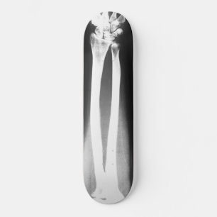 O skate das rupturas por Bradley Boness