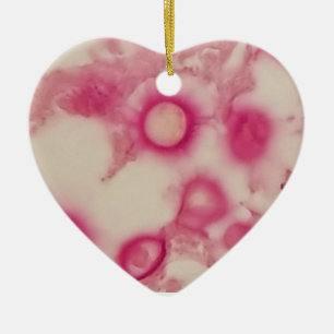 Ornamento Criptococico