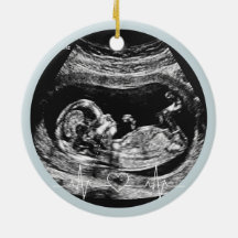 É um Menino Anúncio de Gravidez Ultrassom Bebê