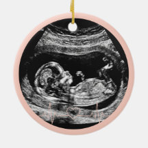 É uma menina Anúncio de Gravidez Ultrassom Bebê