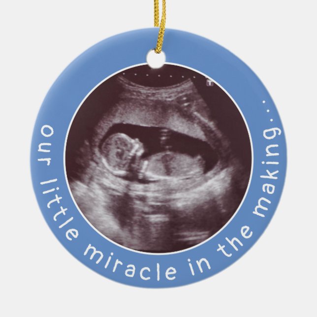 Ornamento De Cerâmica Foto Ultrassom Baby Boy Blue Miracle em Fazer (Frente)