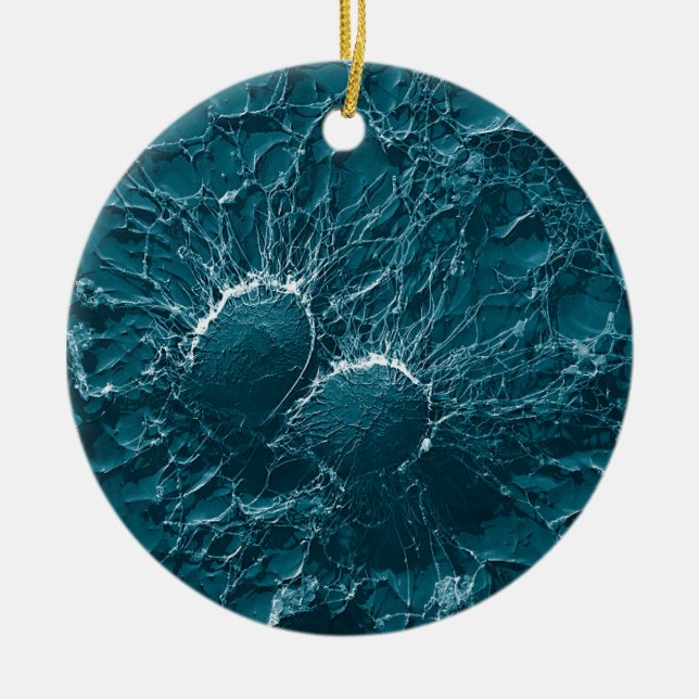 Ornamento De Cerâmica Pilhas bacterianas do staphylococcus - fim áureo (Frente)