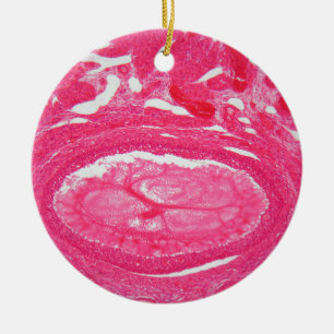 Ornamento De Cerâmica Pilhas do ovário sob o microscópio