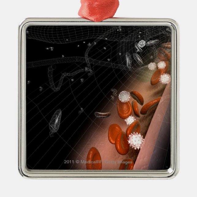 Ornamento De Metal Chapa nas artérias (Frente)