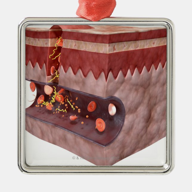 Ornamento De Metal Formação do coágulo de sangue (Frente)