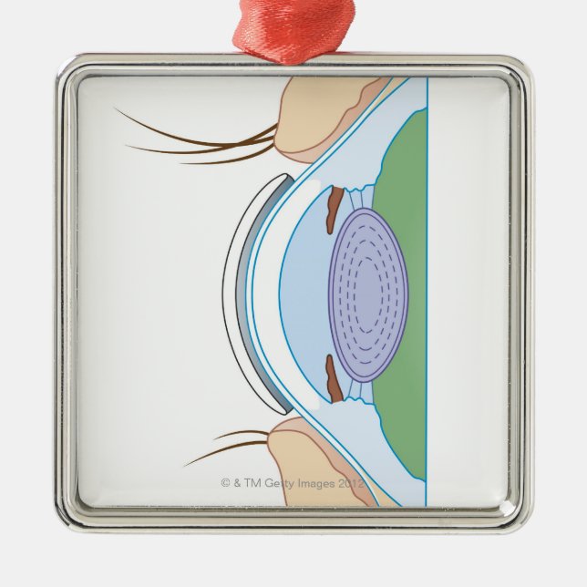 Ornamento De Metal Lente de contato macia (Frente)