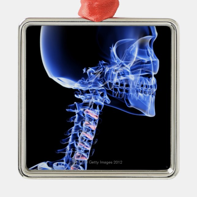 Ornamento De Metal Ossos da cabeça e do pescoço (Frente)