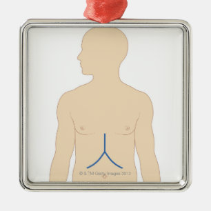 Ornamento De Metal Transplantação do fígado