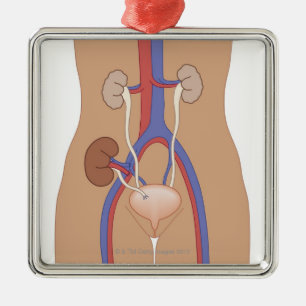 Ornamento De Metal Transplantação do rim