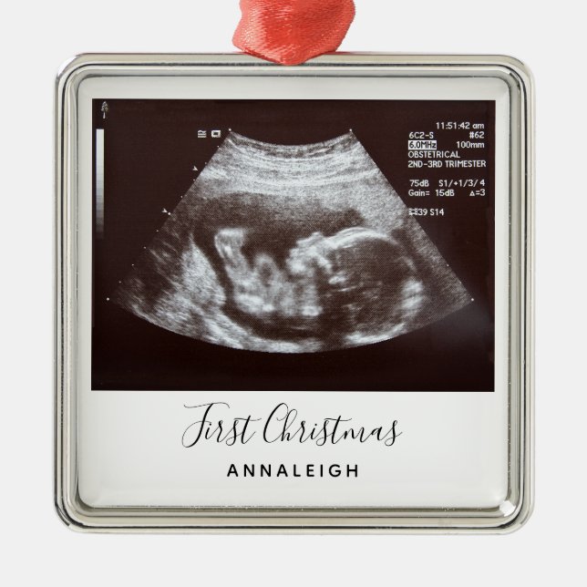 Ornamento De Metal Ultrassom Foto Primeiro Natal Gravidez (Frente)