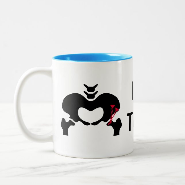 Osteotomy Peri-acetabular clássico da caneca de (Esquerda)