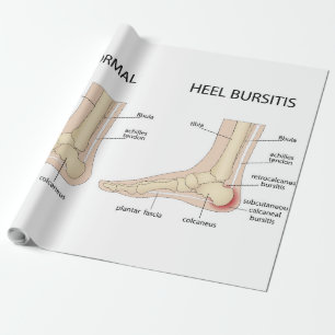 Papel De Presente Deformidade de Haglund