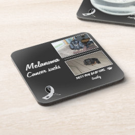 Porta-copo Melanoma Pet Memorial with Two Photos