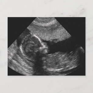 Postal cara de bebê, cartão