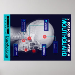 Póster 5 razões vestir um Mouthguard