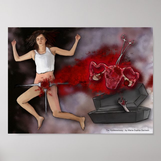 Poster A histerectomia (Frente)