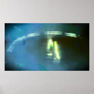 Poster Abstract Arc Light,