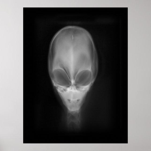 Poster Alienígena Skull X-ray (Frente)