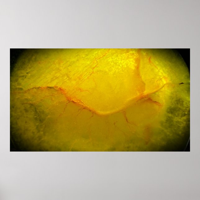 Poster Amarelo Abstrato,  (Frente)
