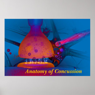 Poster Anatomia da Concussão