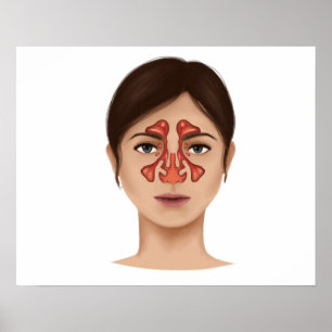 Póster Anatomia de cavidades nasais