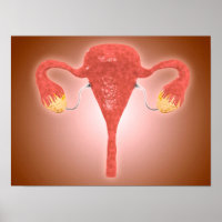 Anatomia Do Útero Feminino Com Ovários