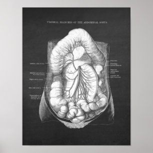 Poster Aorta Abdominal Anatomia