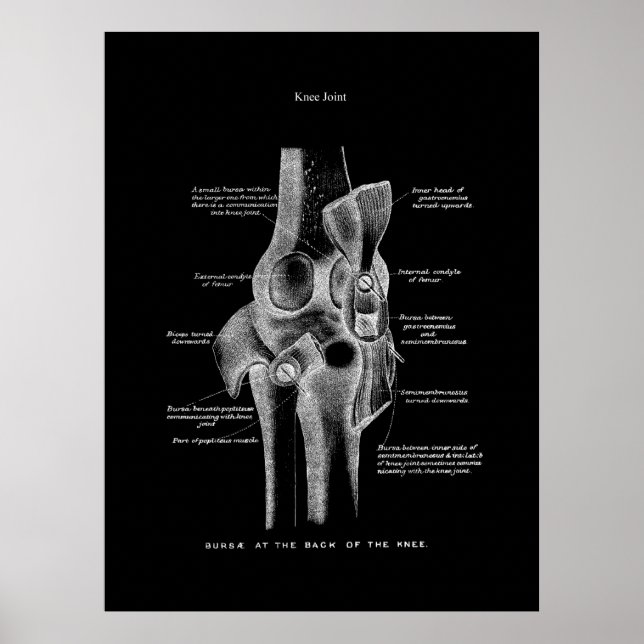 Poster Artes do joelho Anatomia (Frente)