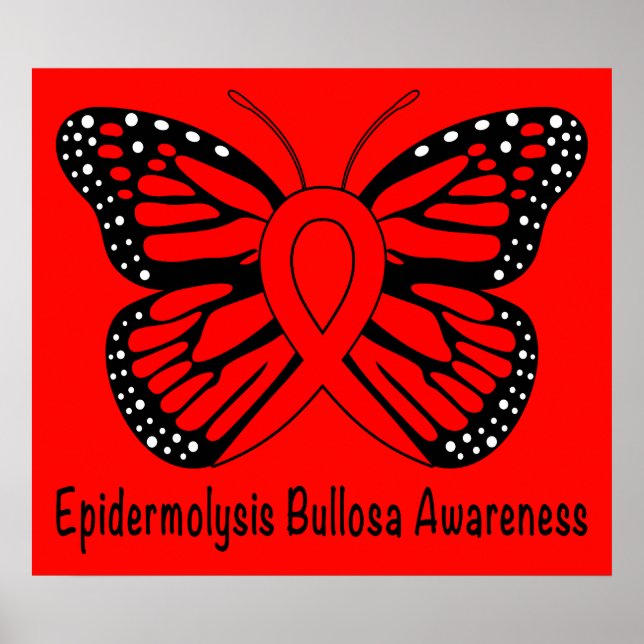 Poster Bullosa de Epidermolise (EB) (Frente)
