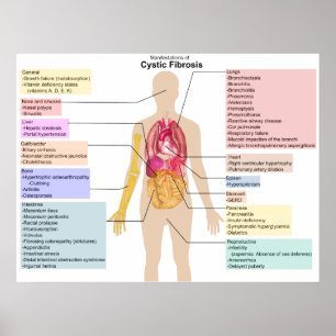 Poster Carta detalhada dos sintomas da fibrose cística