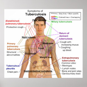 Póster Carta do sintoma da tuberculose nos seres humanos
