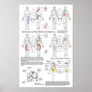 Póster Carta visceral da referência da dor de Sclerotome
